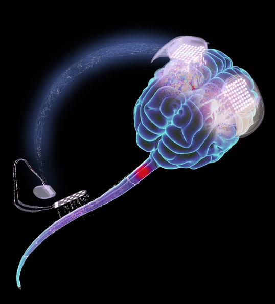 cervello wirless